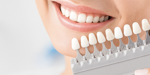 PICK UP ホワイトニング